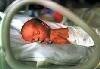 Retinopathy Of Prematurity (ROP) Is Due To Hypoxia